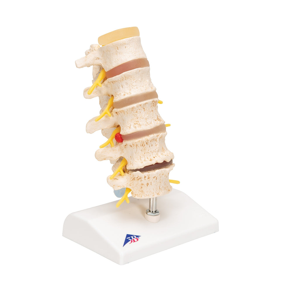 Spine Degeneration Model