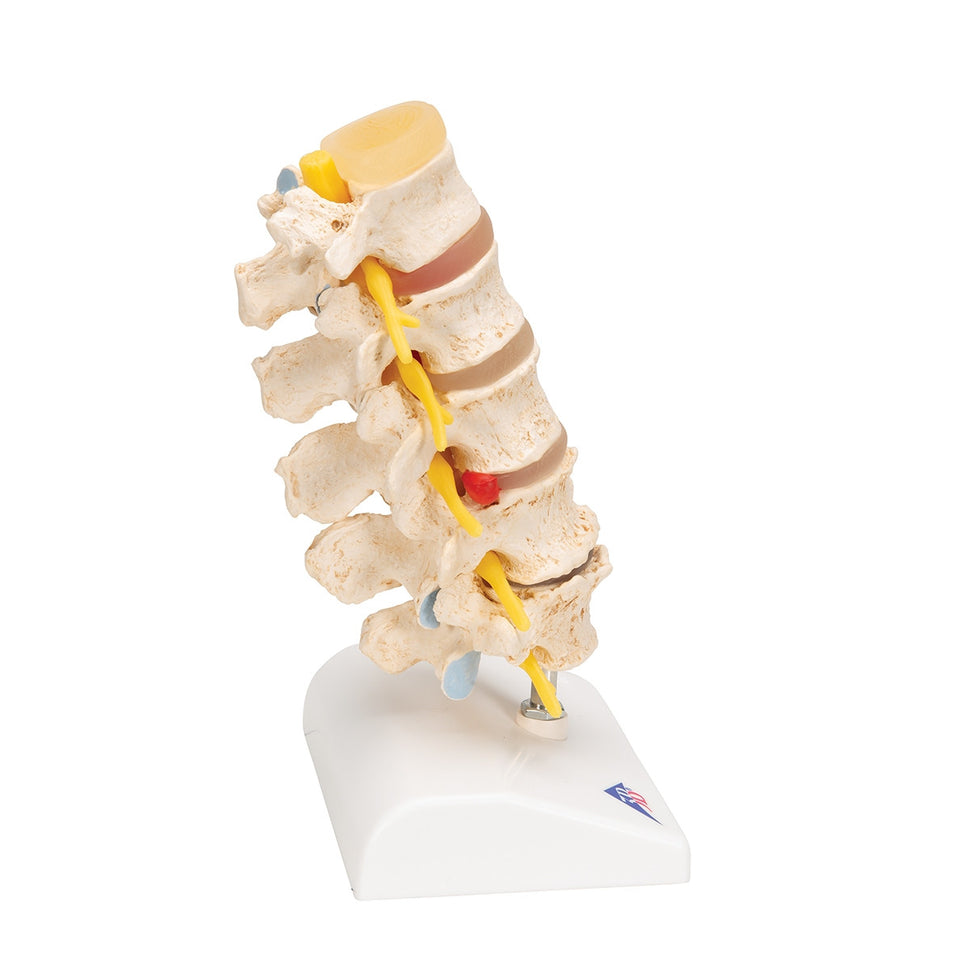Spine Degeneration Model