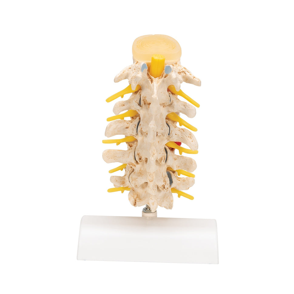 Spine Degeneration Model