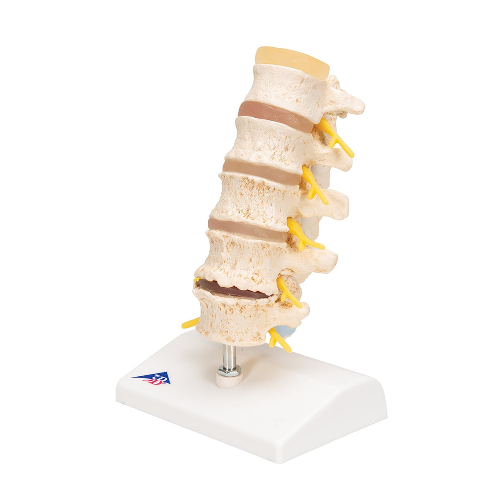 Spine Degeneration Model