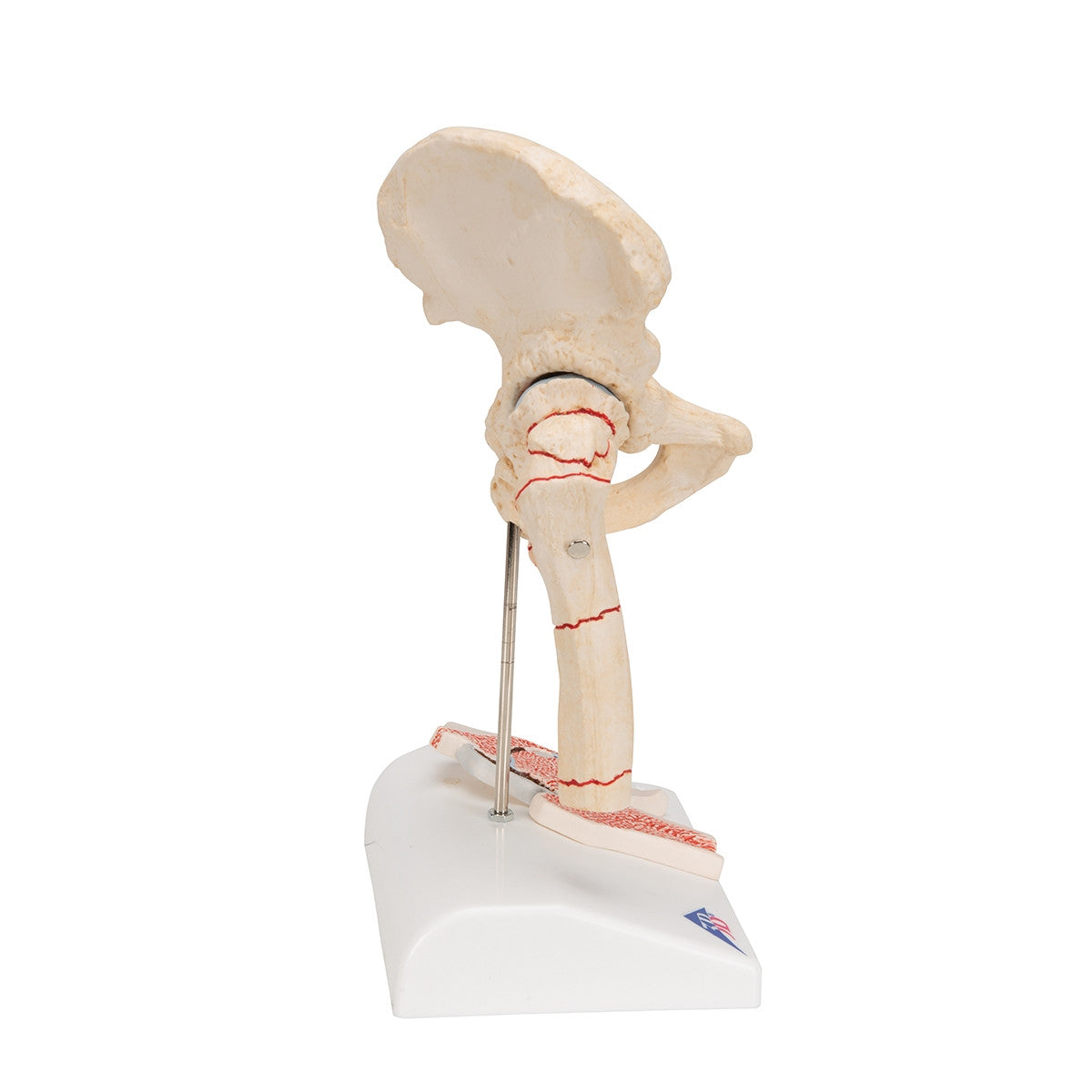 Femoral Fracture and Hip Osteoarthritis Model