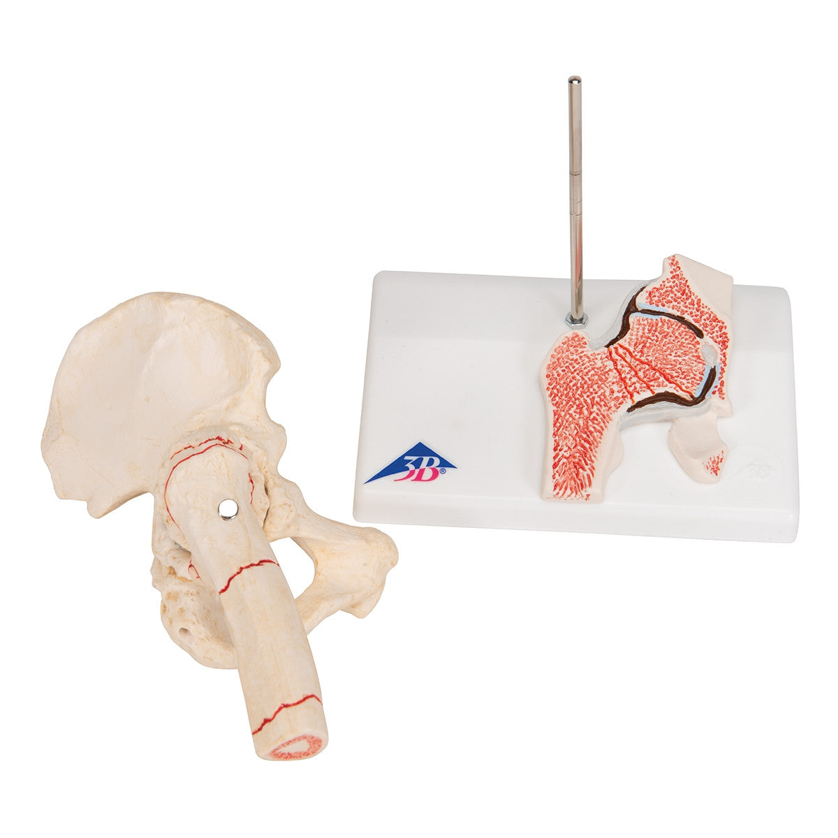 Femoral Fracture and Hip Osteoarthritis Model