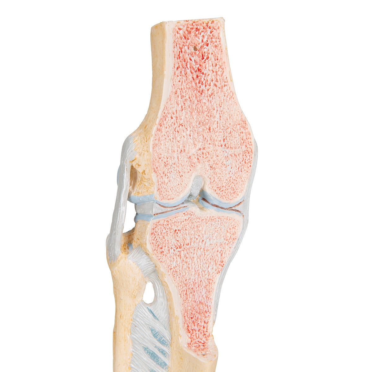 Knee Section Model (3 part)