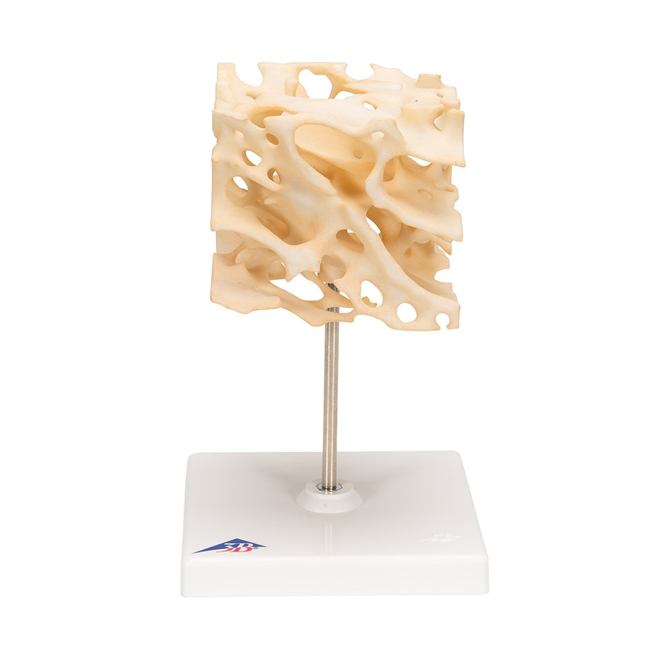 Cancellous Bone Model (x 100 enlarged)