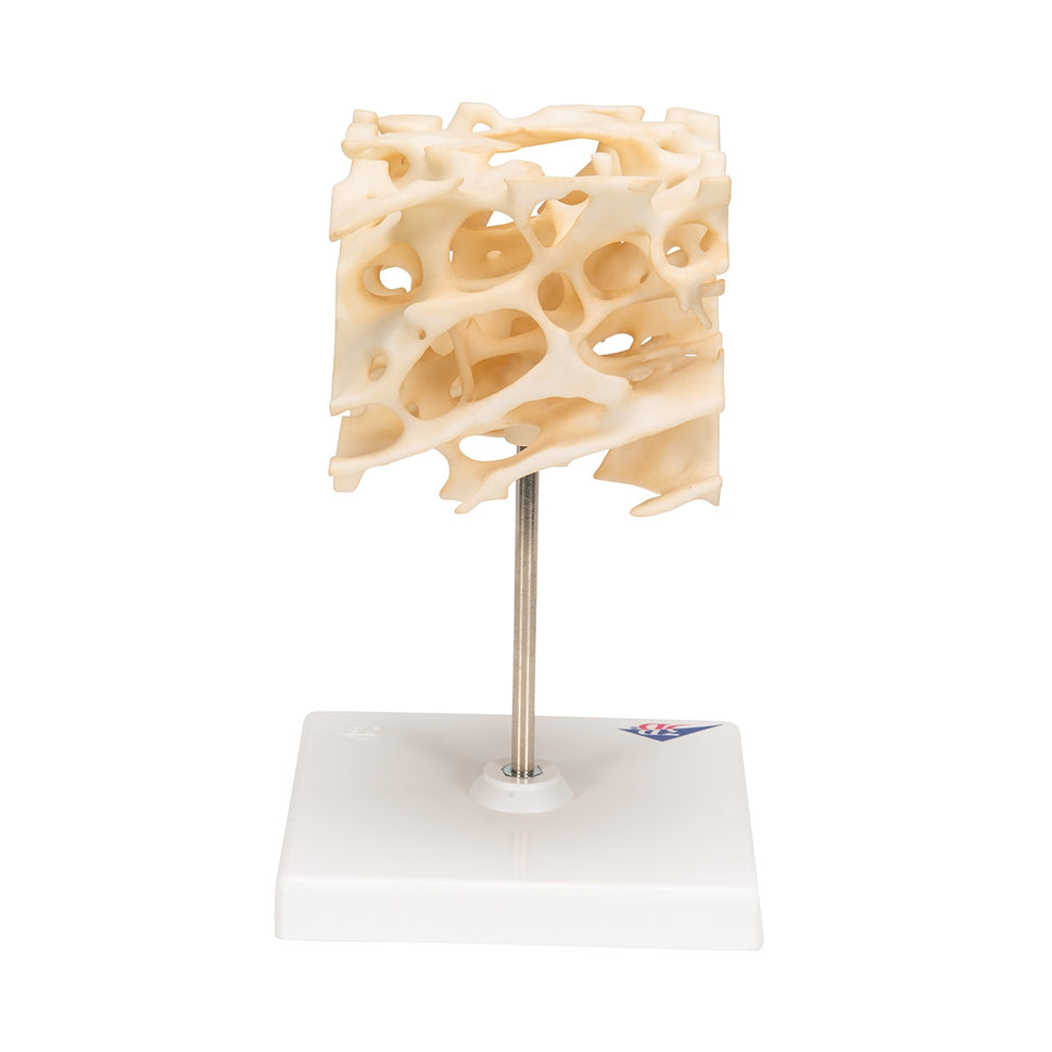Cancellous Bone Model (x 100 enlarged)