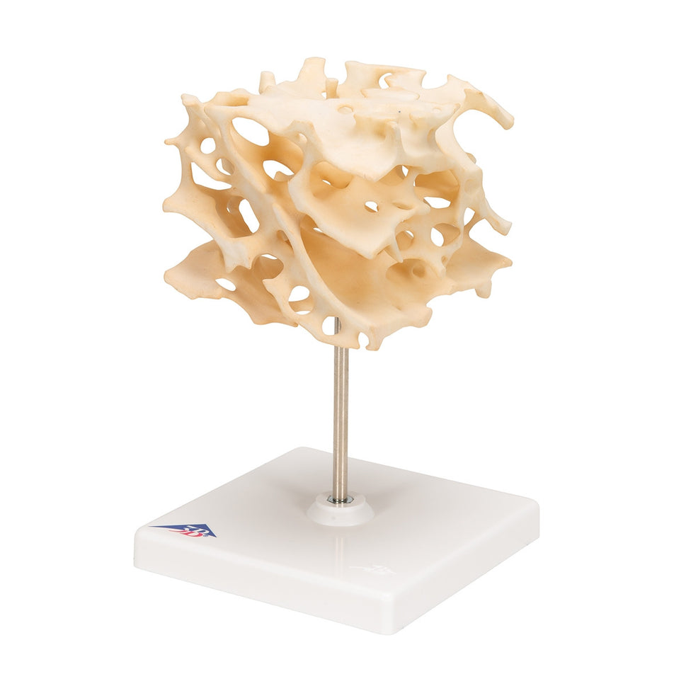 Cancellous Bone Model (x 100 enlarged)