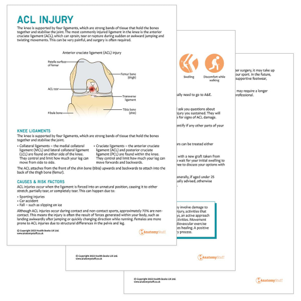 ACL Injury Patient Education Handout (Printable PDF)