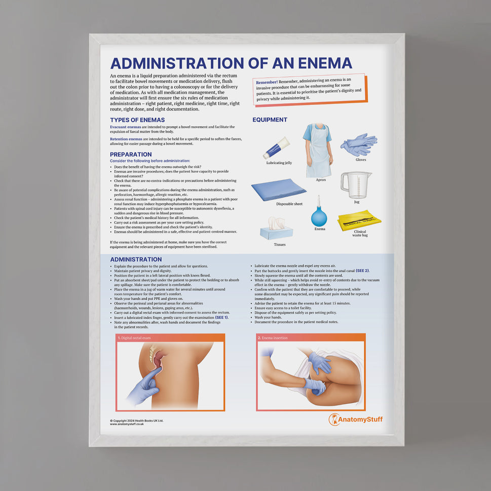 Administration of an Enema Chart / Poster