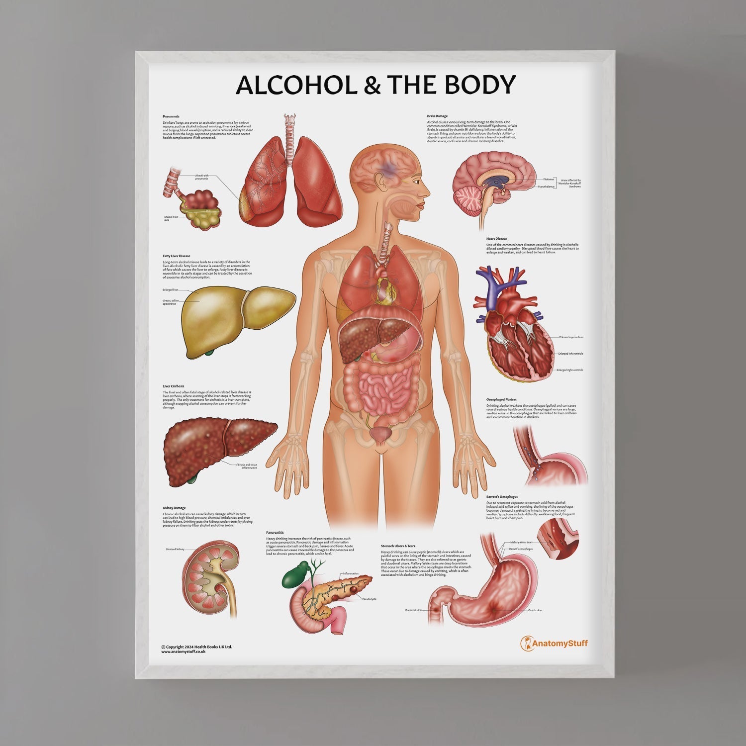 Alcohol and The Body Chart / Poster - Part of Collection