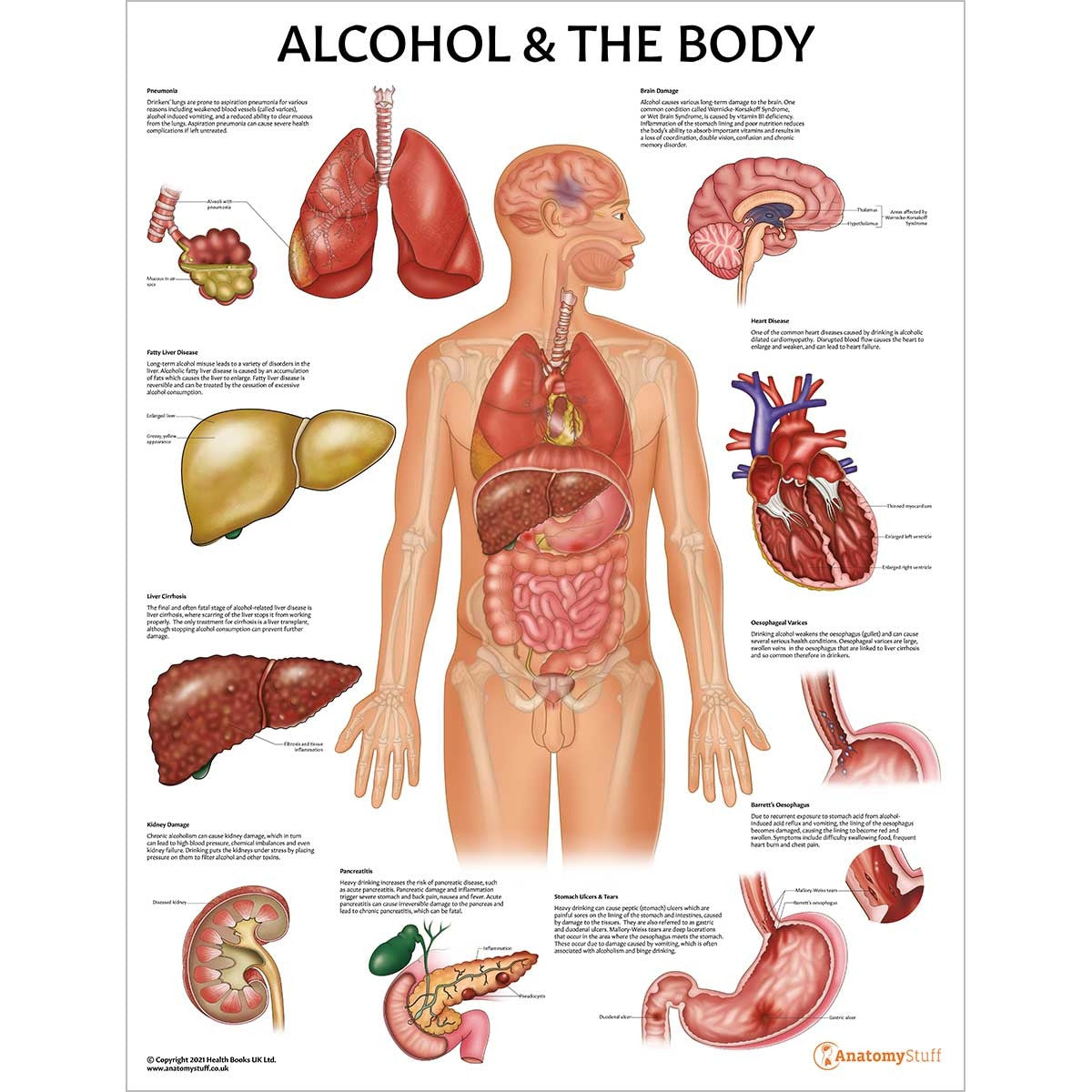 Substances and The Body 4 Poster Collection (Laminated)