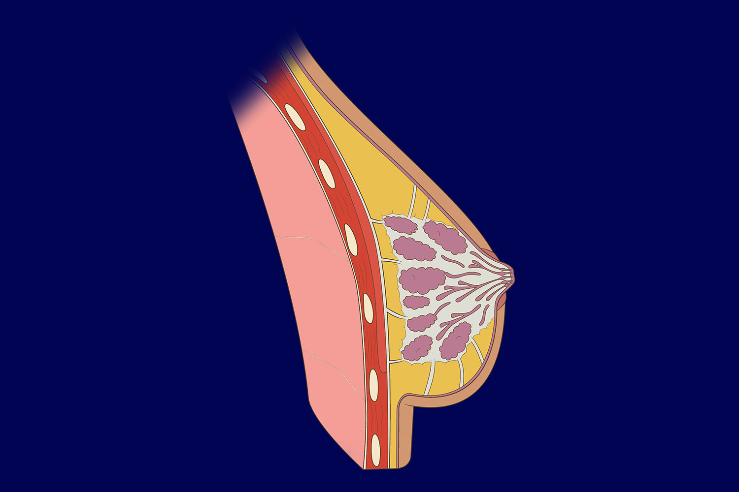 Breast Revision Guide