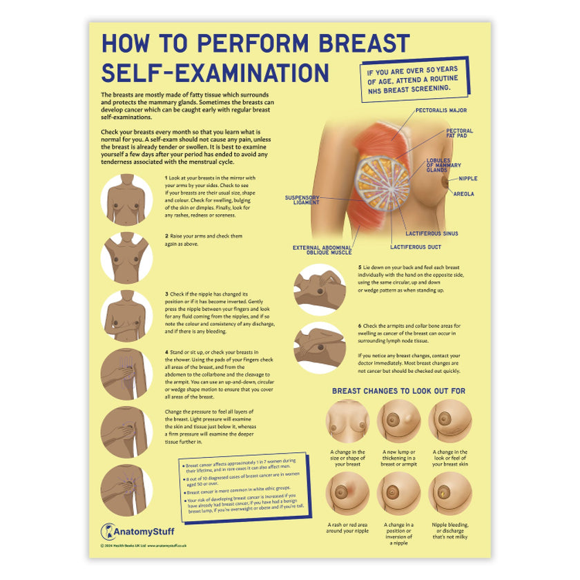 How to Perform Breast Self Examination (BSE) Chart / Poster