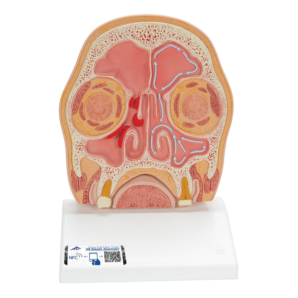 Head Section Model with Sinusitis