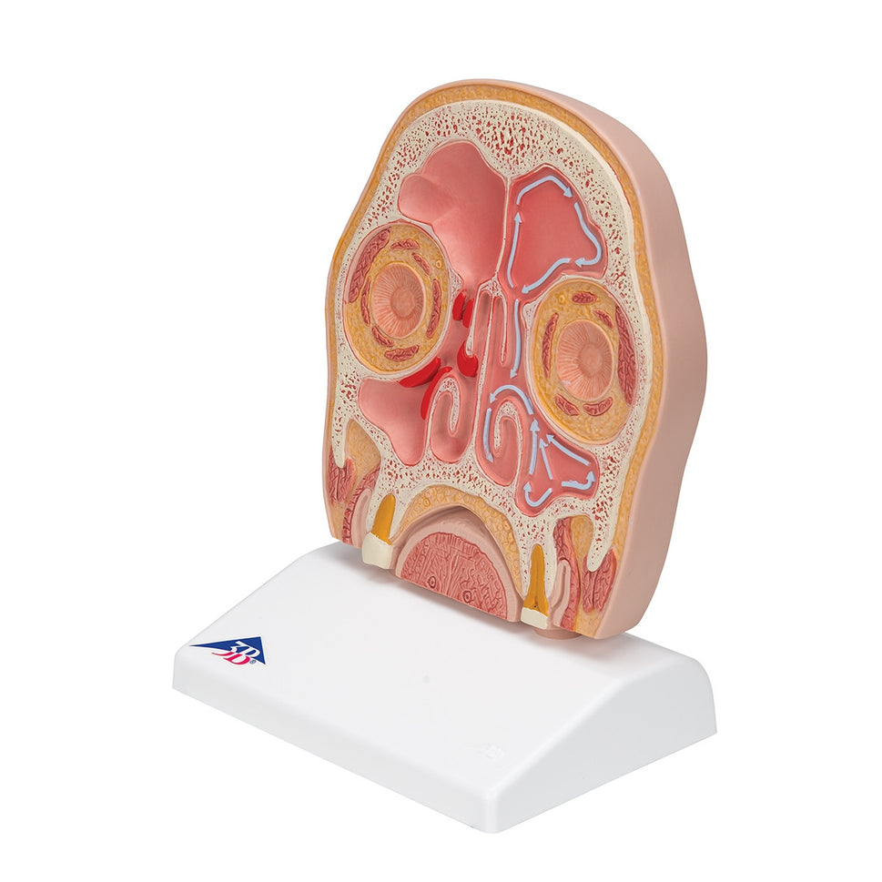 Head Section Model with Sinusitis