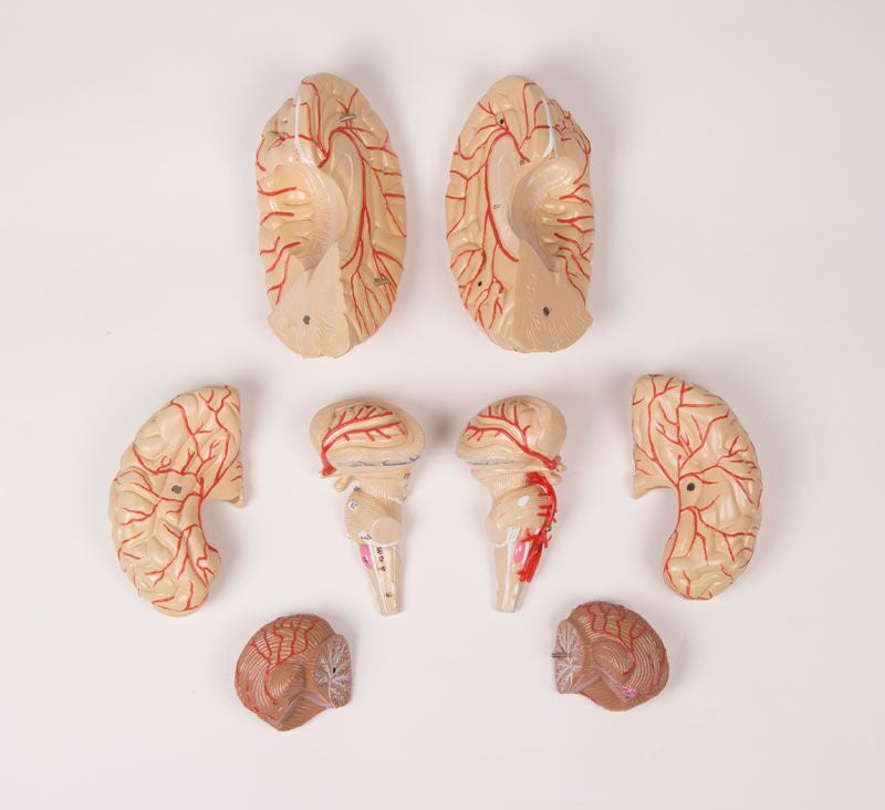 Brain Model with Arteries (9 part)