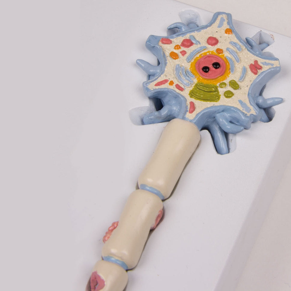 Neuron Model with Stages of Multiple Sclerosis
