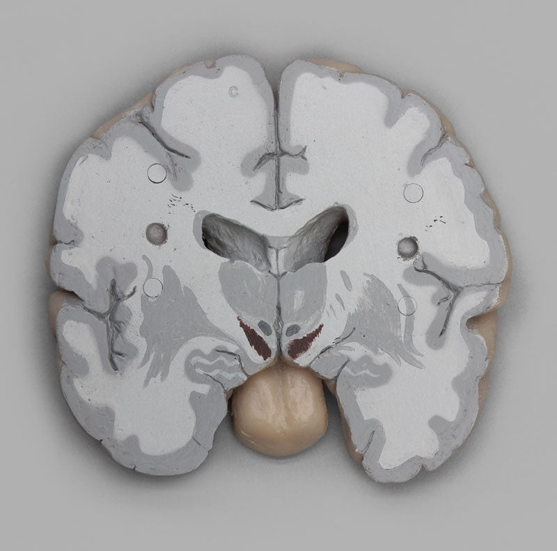 Brain Multiple Frontal Sections Model