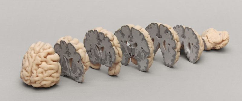 Brain Multiple Frontal Sections Model KO-515