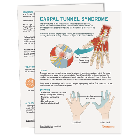 <strong>Carpal Tunnel Syndrome</strong>