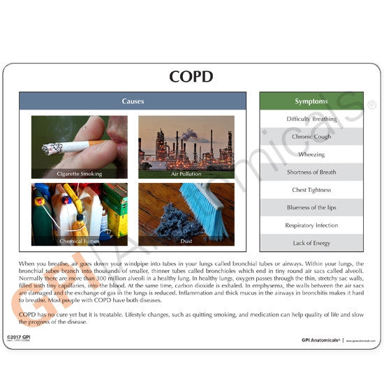 COPD Model (4 part)