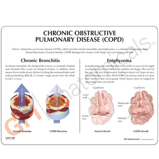 COPD Model (4 part)