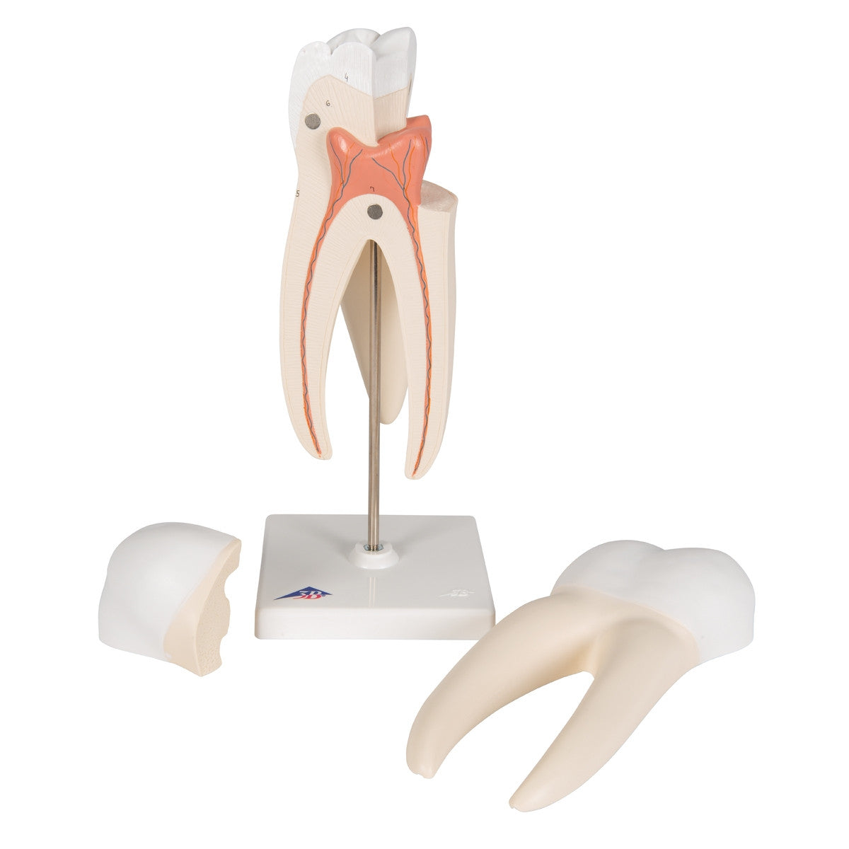 Upper Triple-Root Molar Tooth Model (3 part)