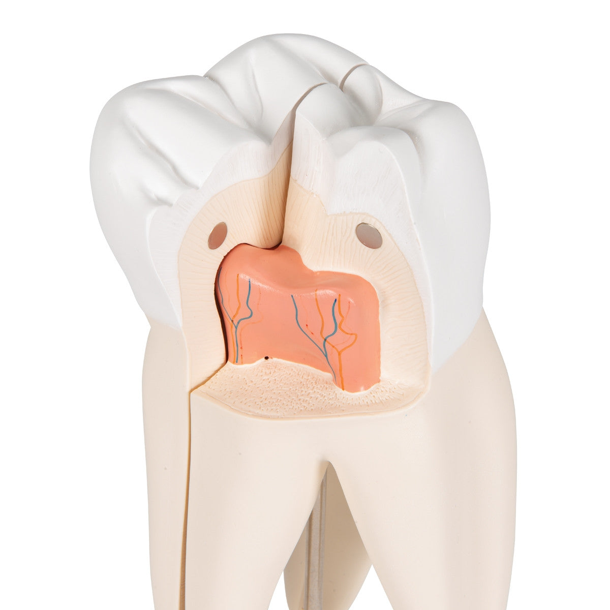 Upper Triple-Root Molar Tooth Model (3 part)