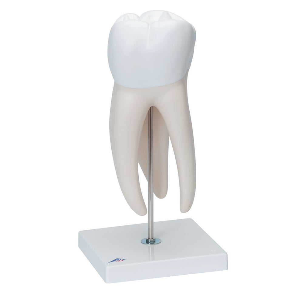 Giant Molar Model with Dental Cavities (15 times life size, 5 part)