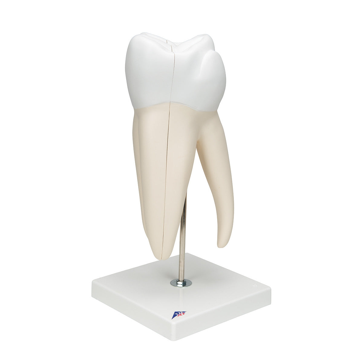 Giant Molar Model with Dental Cavities (15 times life size, 5 part)