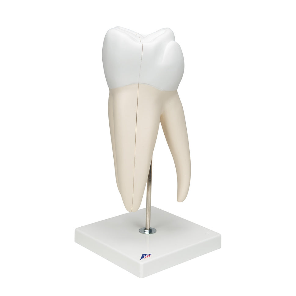 Giant Molar Model with Dental Cavities (15 times life size, 5 part)
