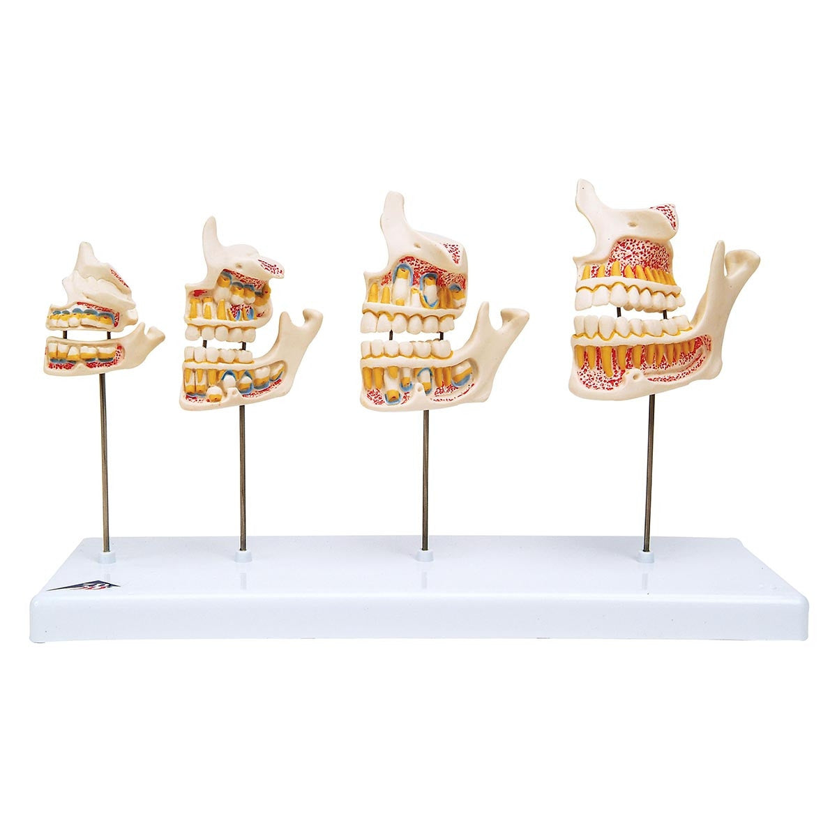 Dentition Development Series (4 Stages)