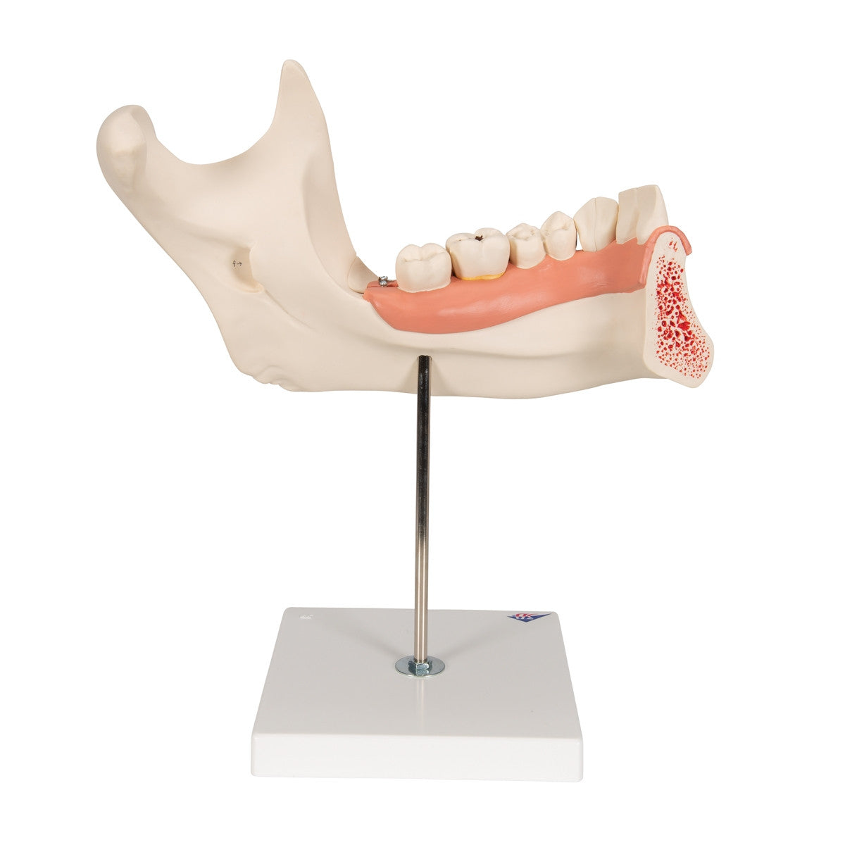 Half Lower Jaw Model (3 times full size, 6 part)
