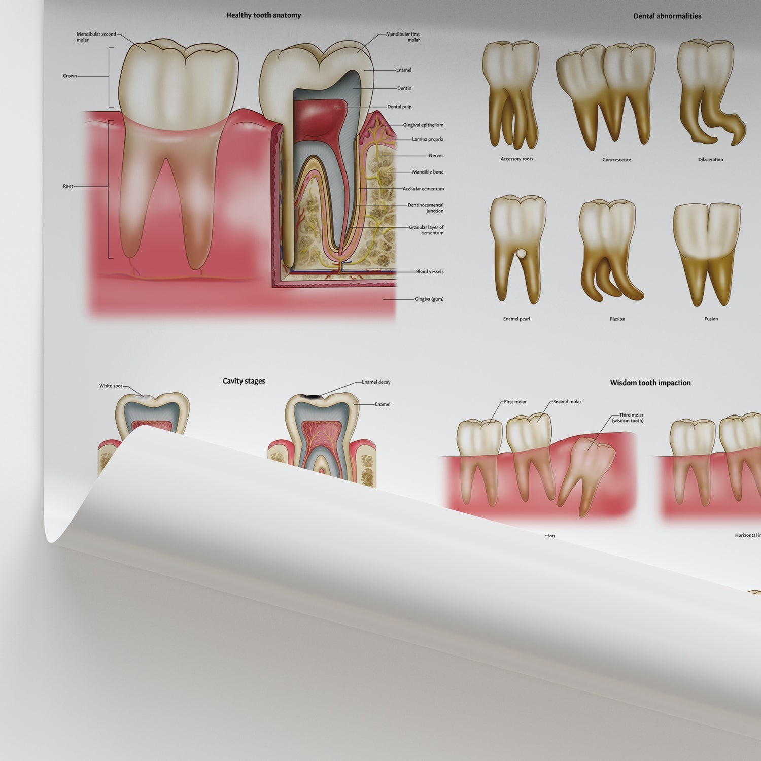 Dental Diseases & Disorders Chart / Poster - Part of Collection