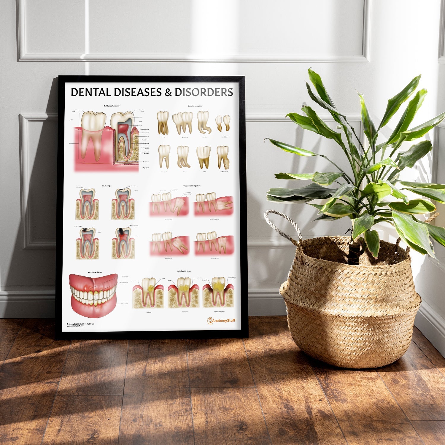 Dental Diseases & Disorders Chart / Poster - Part of Collection