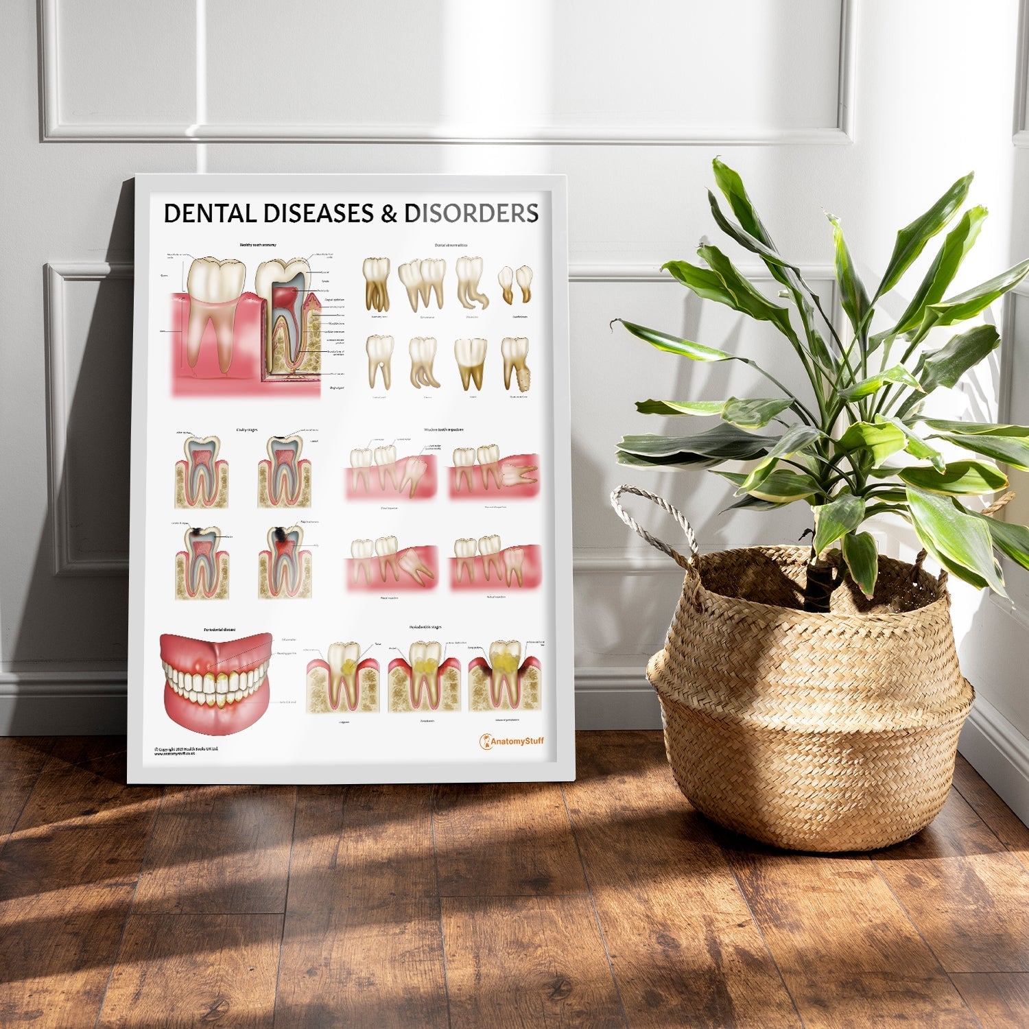 Dental Diseases & Disorders Chart / Poster - Part of Collection