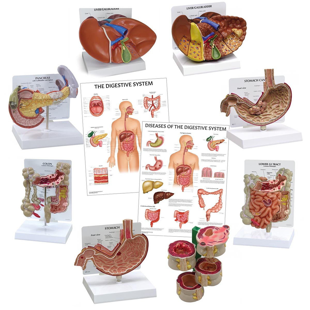 Digestive System Anatomy and Pathology Collection Bundle Image