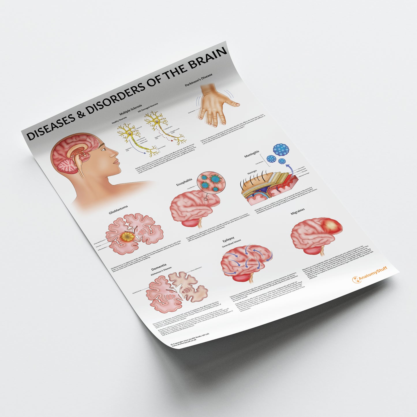 Diseases & Disorders of the Brain Chart / Poster