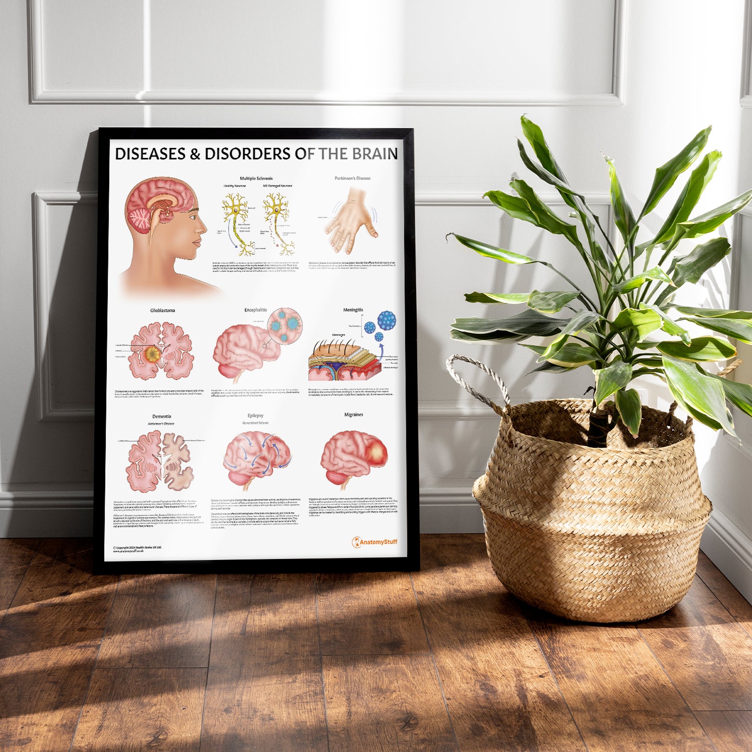 Diseases & Disorders of the Brain Chart / Poster