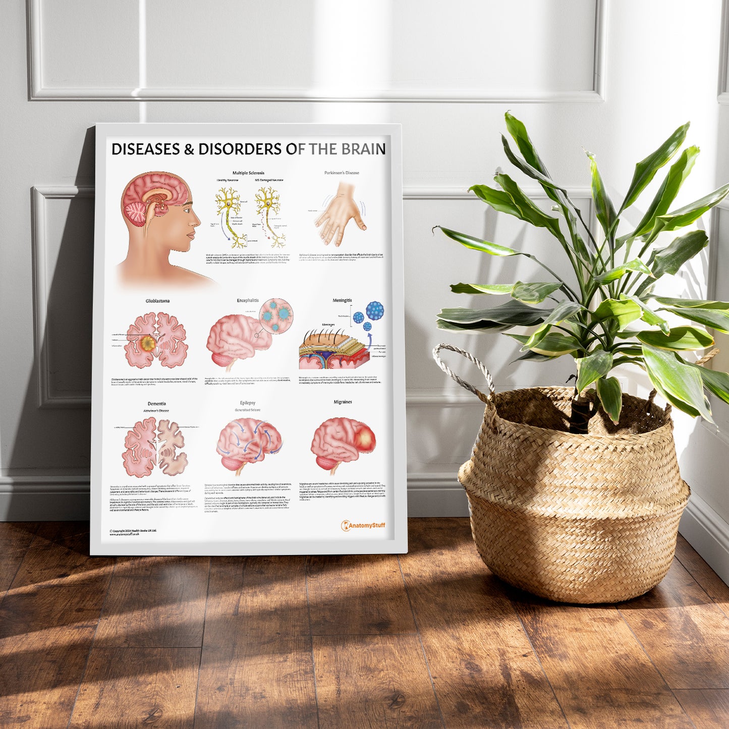 Diseases & Disorders of the Brain Chart / Poster