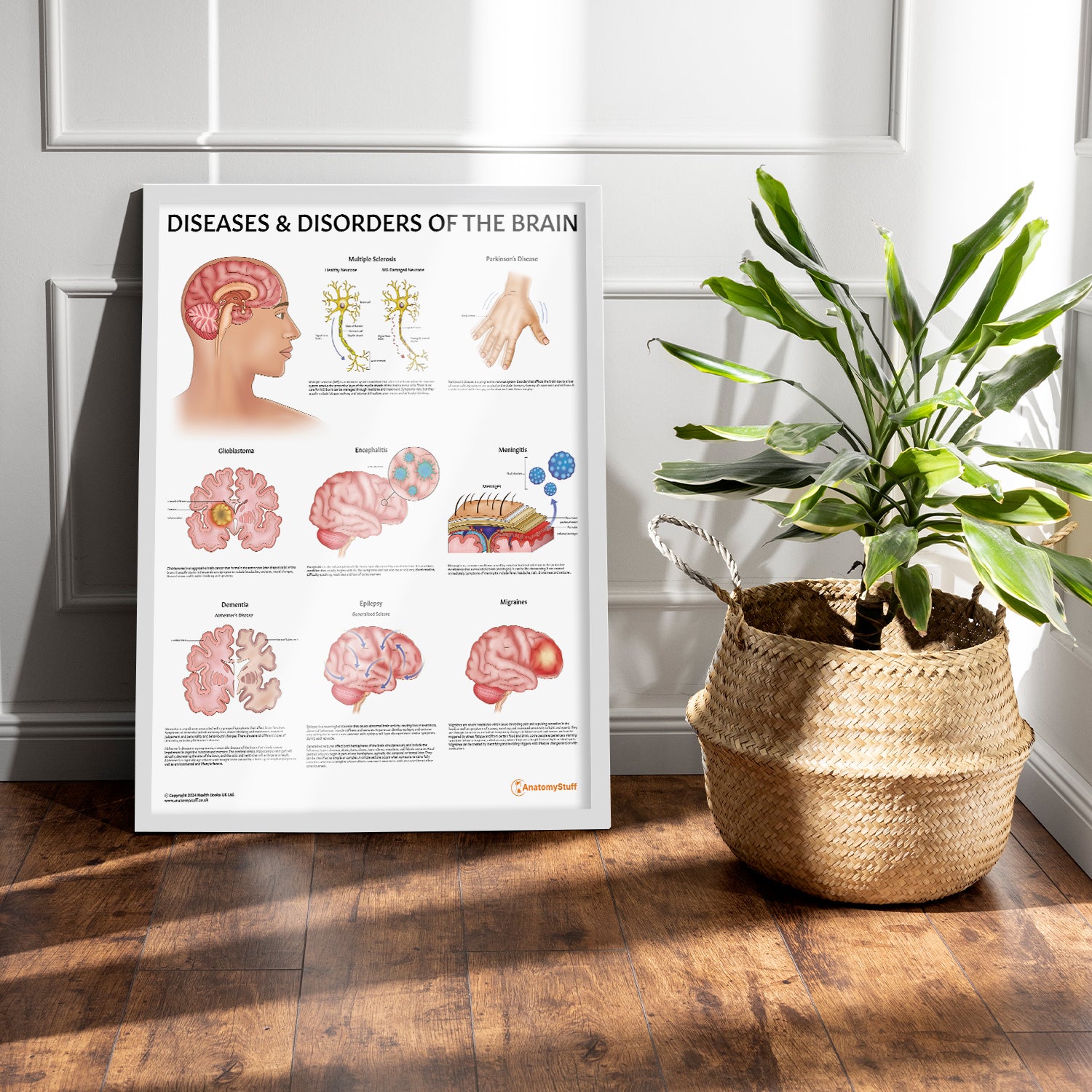 Diseases & Disorders of the Brain Chart / Poster