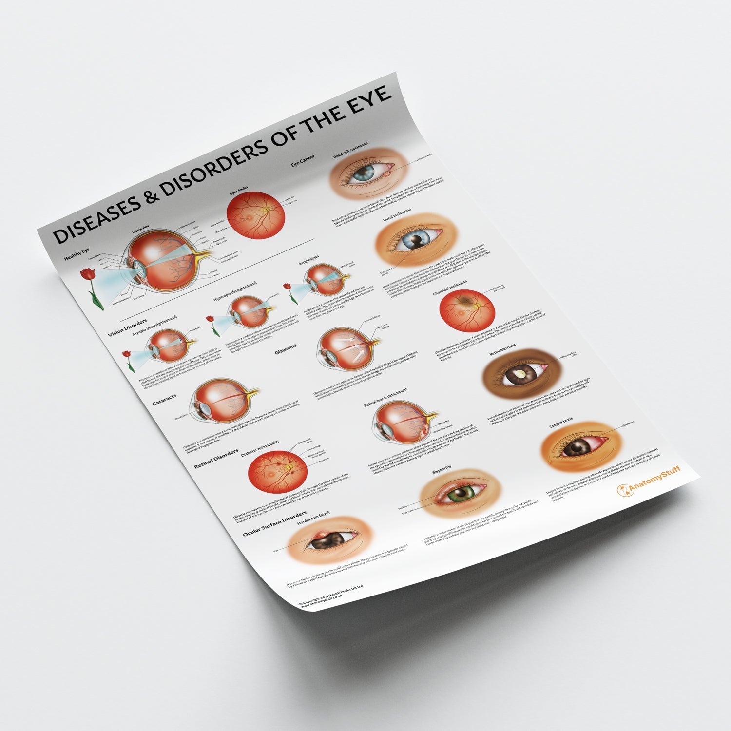 Diseases and Disorders of the Eye Chart / Poster - Part of Collection