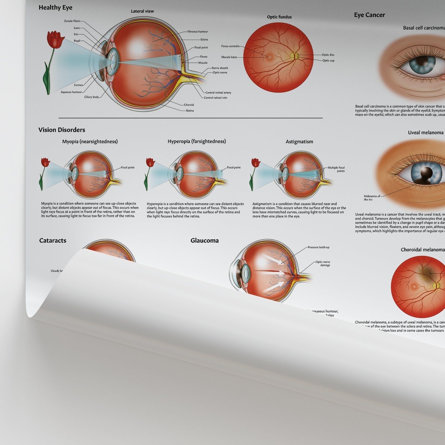 Diseases and Disorders of the Eye Chart / Poster - Part of Collection