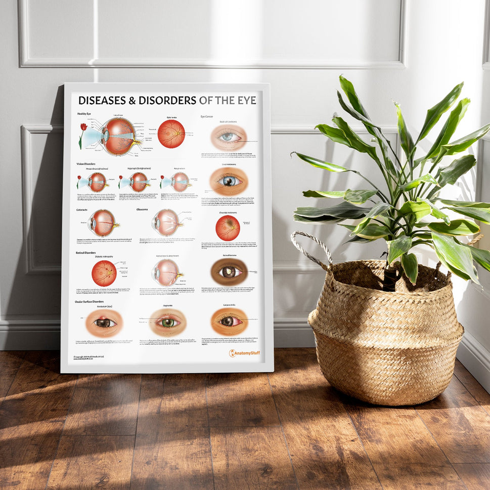 Diseases and Disorders of the Eye Chart / Poster