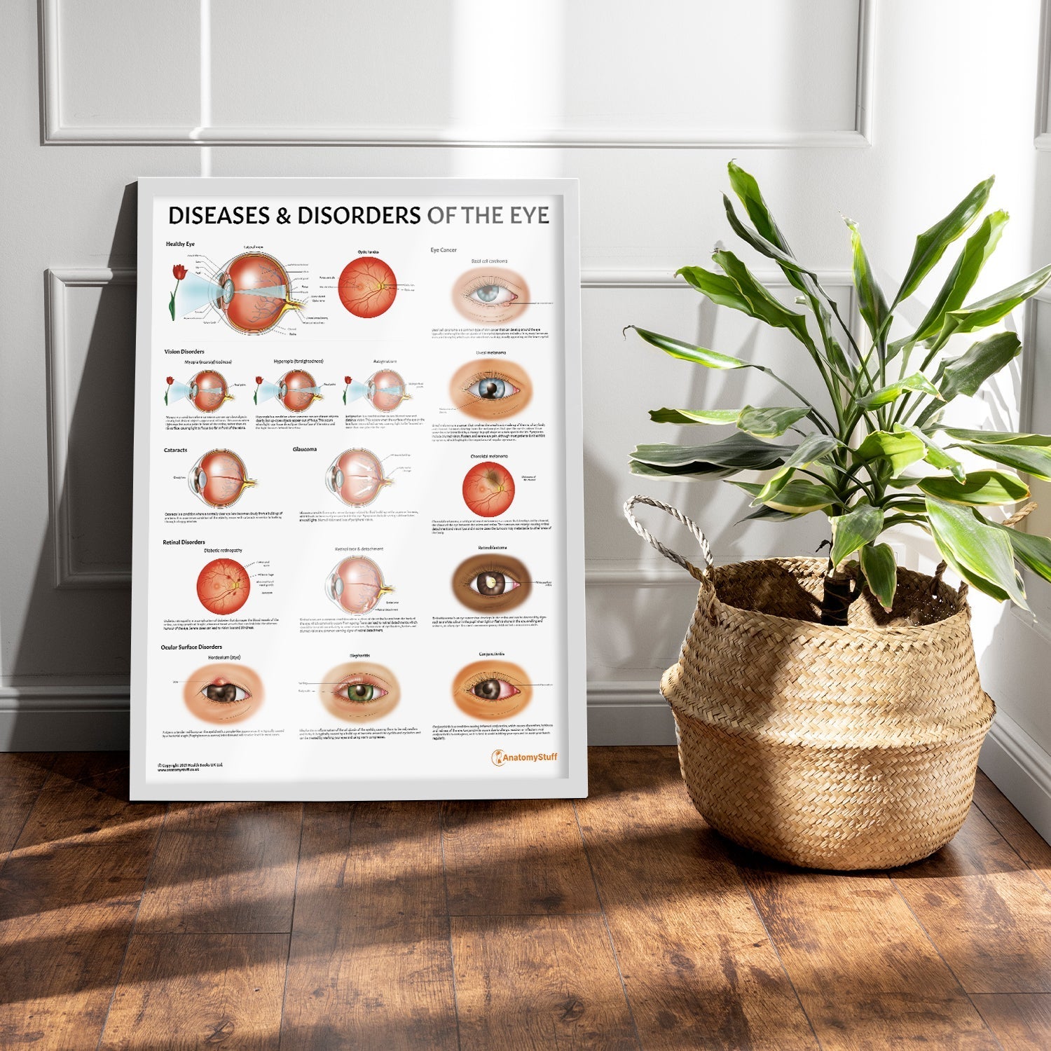Diseases and Disorders of the Eye Chart / Poster - Part of Collection