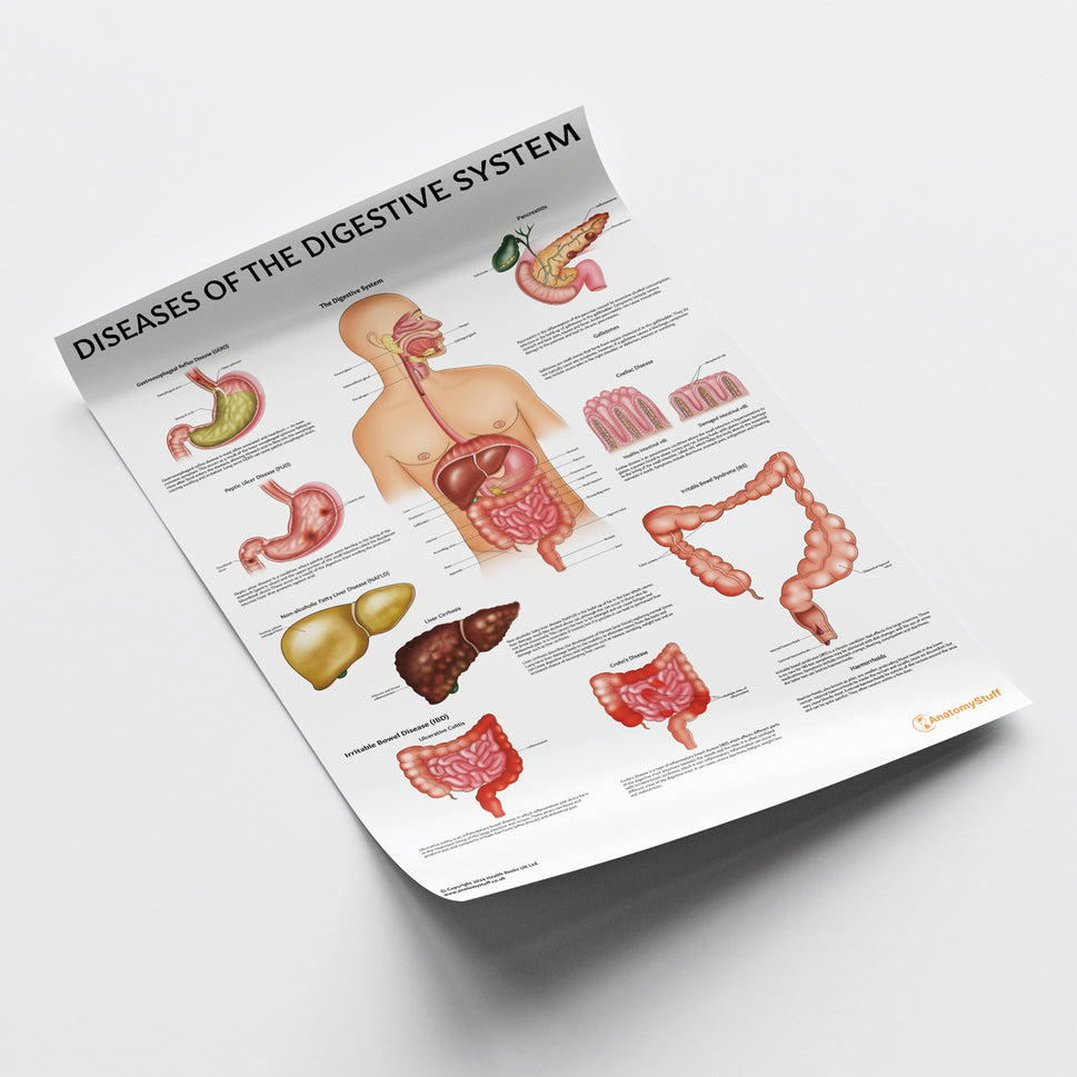 Diseases of the Digestive System Chart / Poster