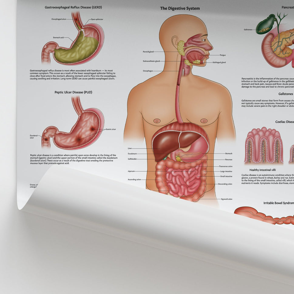 Diseases of the Digestive System Chart / Poster