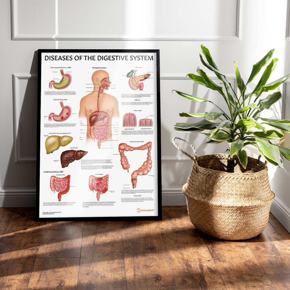 Diseases of the Digestive System Chart / Poster