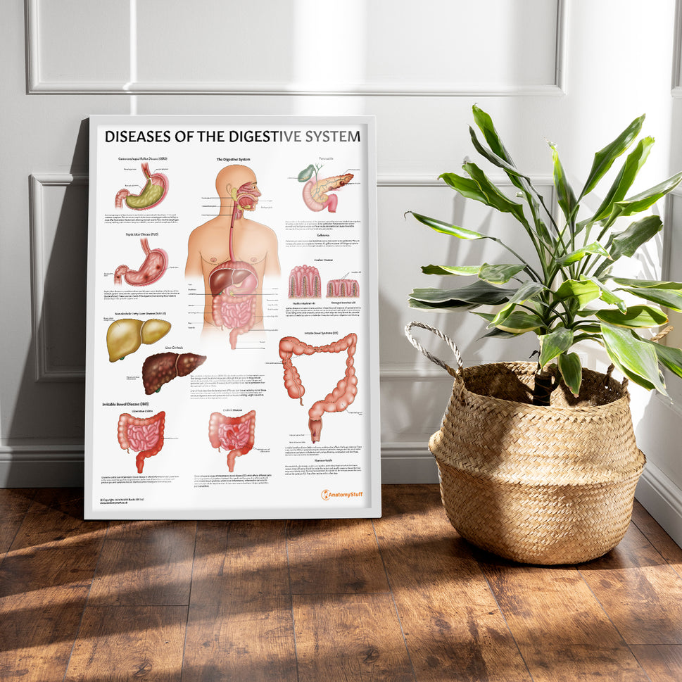 Diseases of the Digestive System Chart / Poster