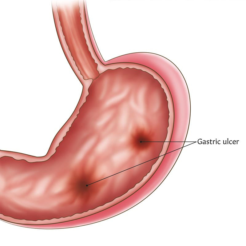 Diseases of the Digestive System Chart / Poster - Part of Collection