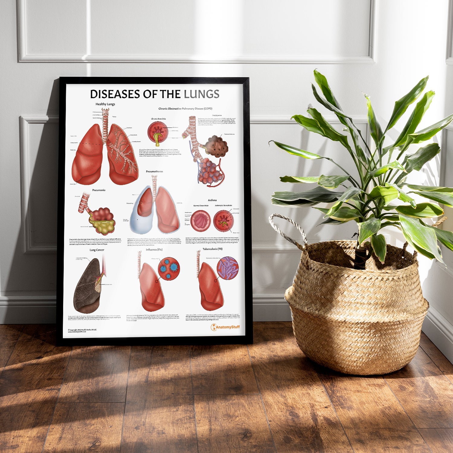 Diseases of the Lungs Chart / Poster - Part of Collection